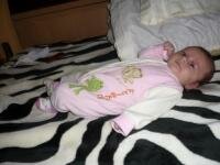 bebe mic cu hemagiom la pleoapa